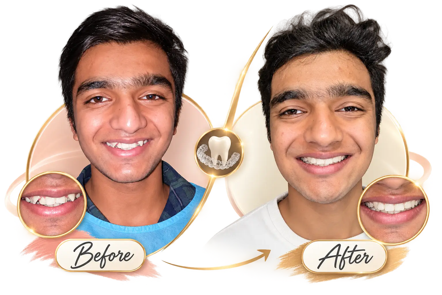 Before-After-1