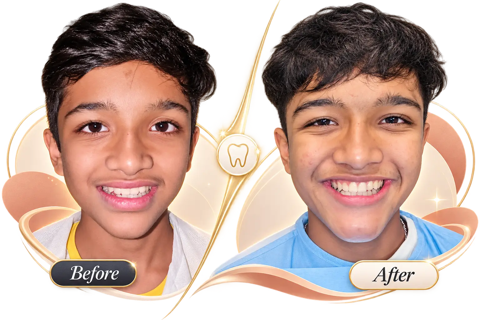 Before-After-2