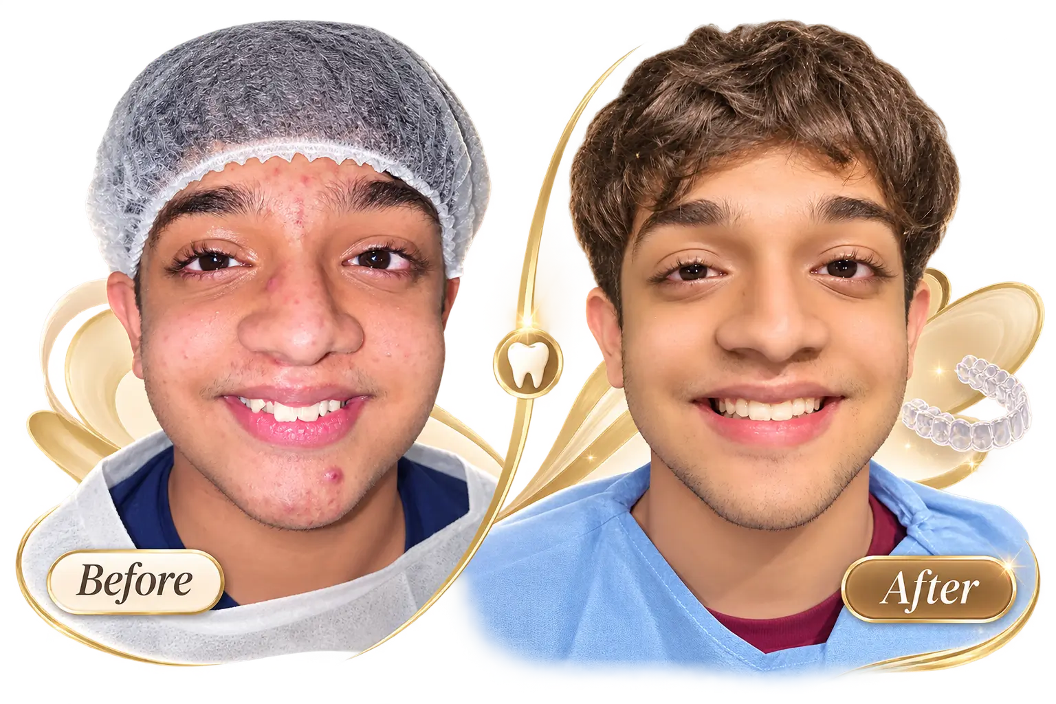 Before-After-3